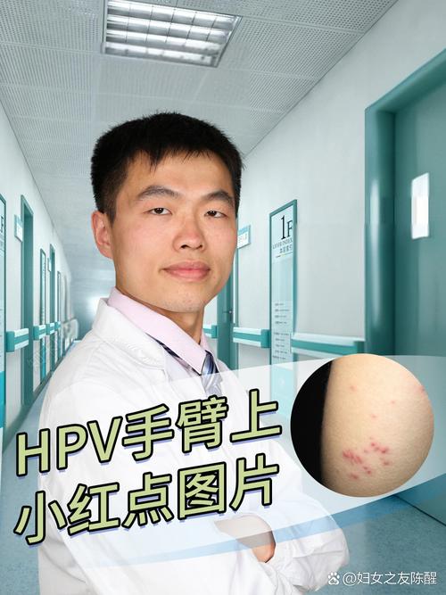 病毒感染起红点多久好