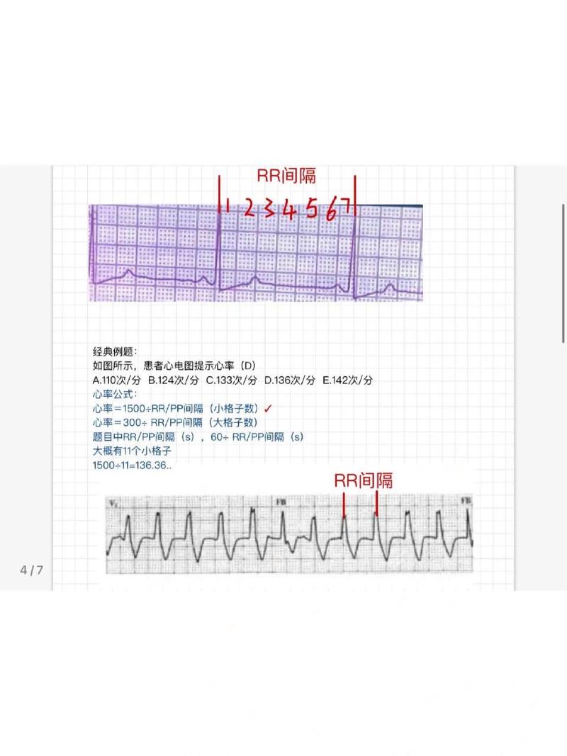心电图计算心率公式
