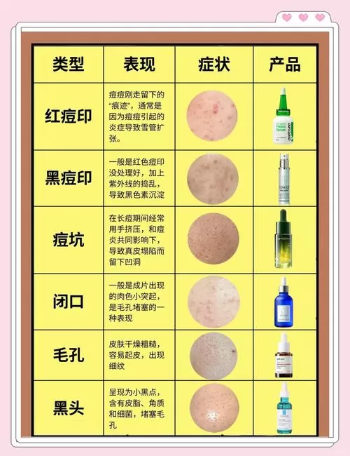 痘坑痘印到底能不能治好