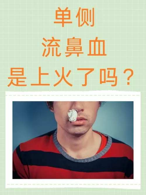 流鼻血是上火了吗