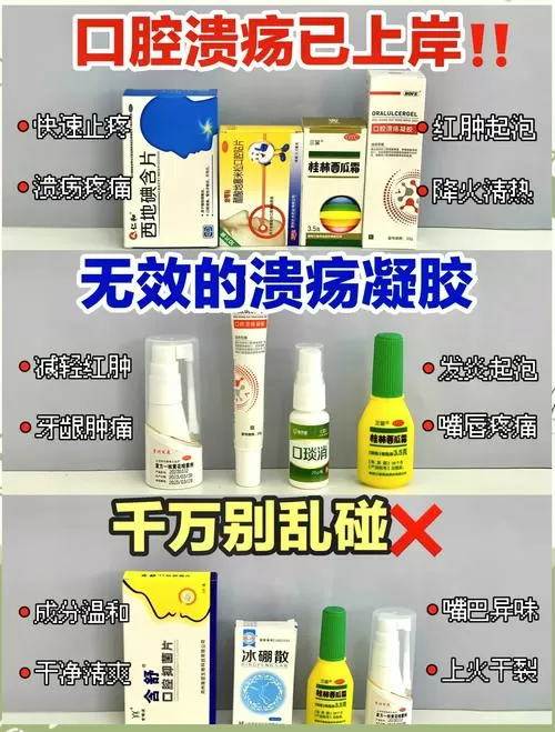 口腔溃疡土方子根治偏方