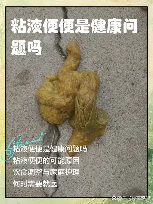 大便表面带白色粘液是怎么回事