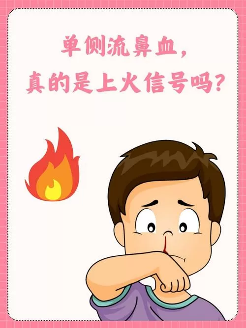 经常单侧流鼻血