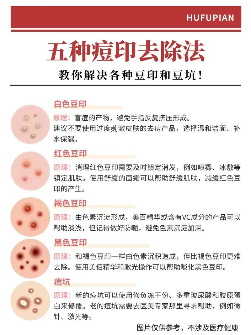 怎样去除豆印子最有效
