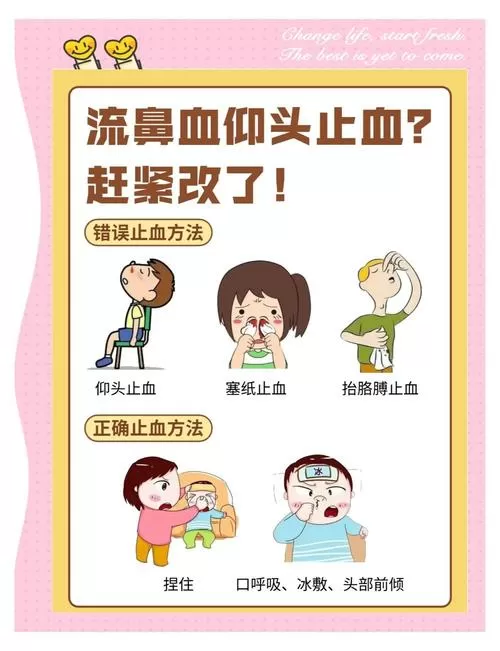 快速流鼻血小窍门