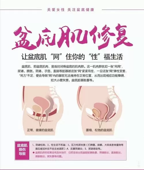 盆底肌修复视频教程