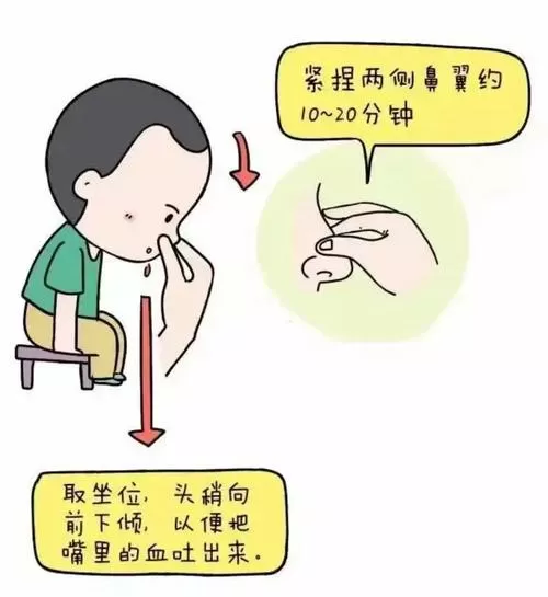 流鼻血怎么快速止住