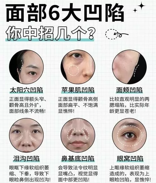 脸颊两侧有窝是咋回事
