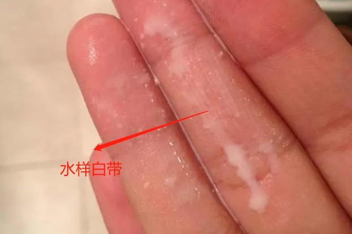 白带水状