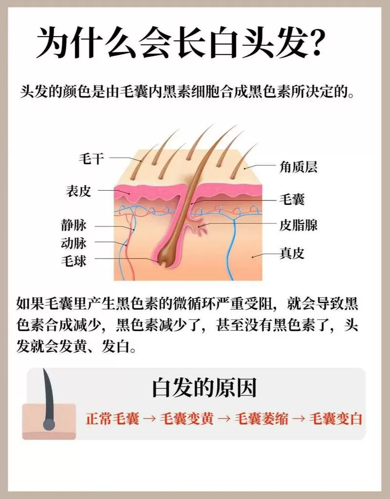 白发的形成原因