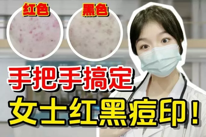 红色豆印怎么去掉