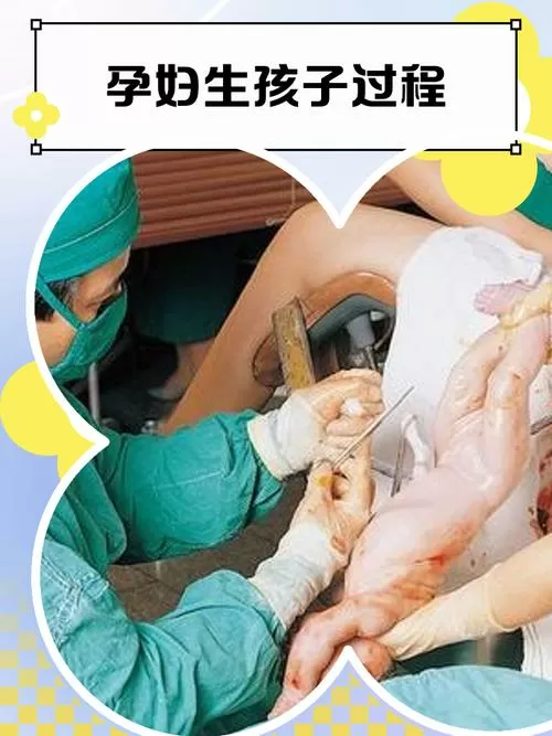 模拟人生孕妇怎么难产