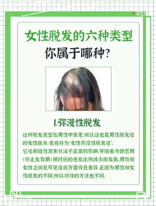 20岁女生掉头发厉害是什么原因引起的
