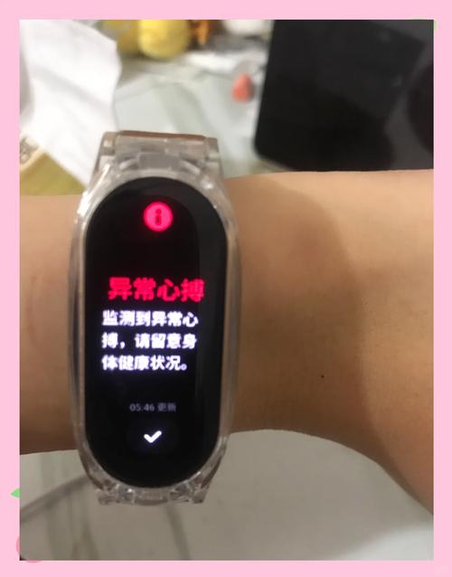 小米手环通知不提醒了