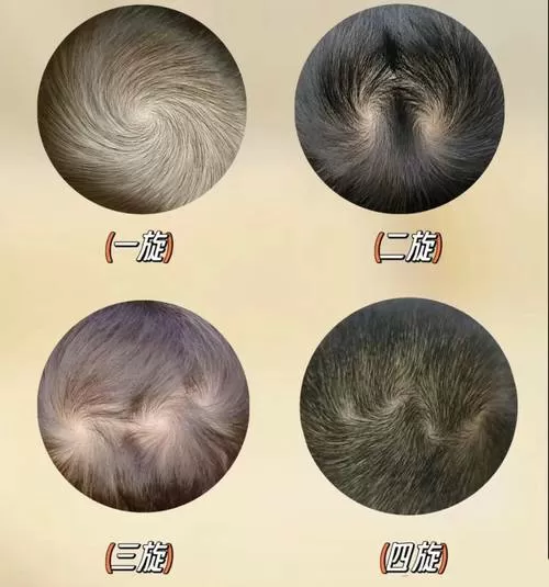 头顶双旋的孩子说明什么