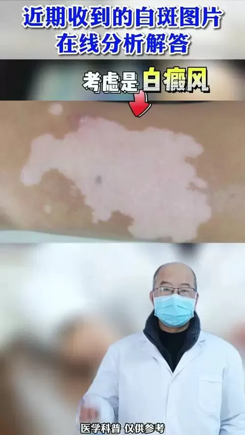 早期白旋风的图片