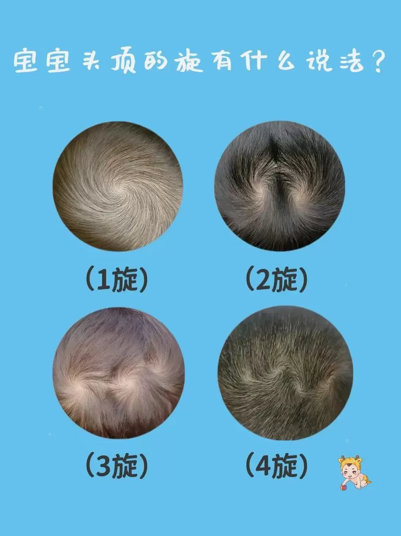 头发有发旋如何消除截图