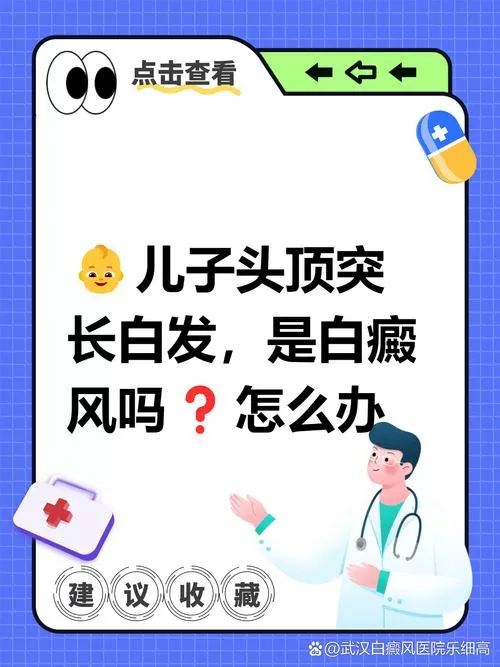 孩子有白头发是缺少什么微量元素