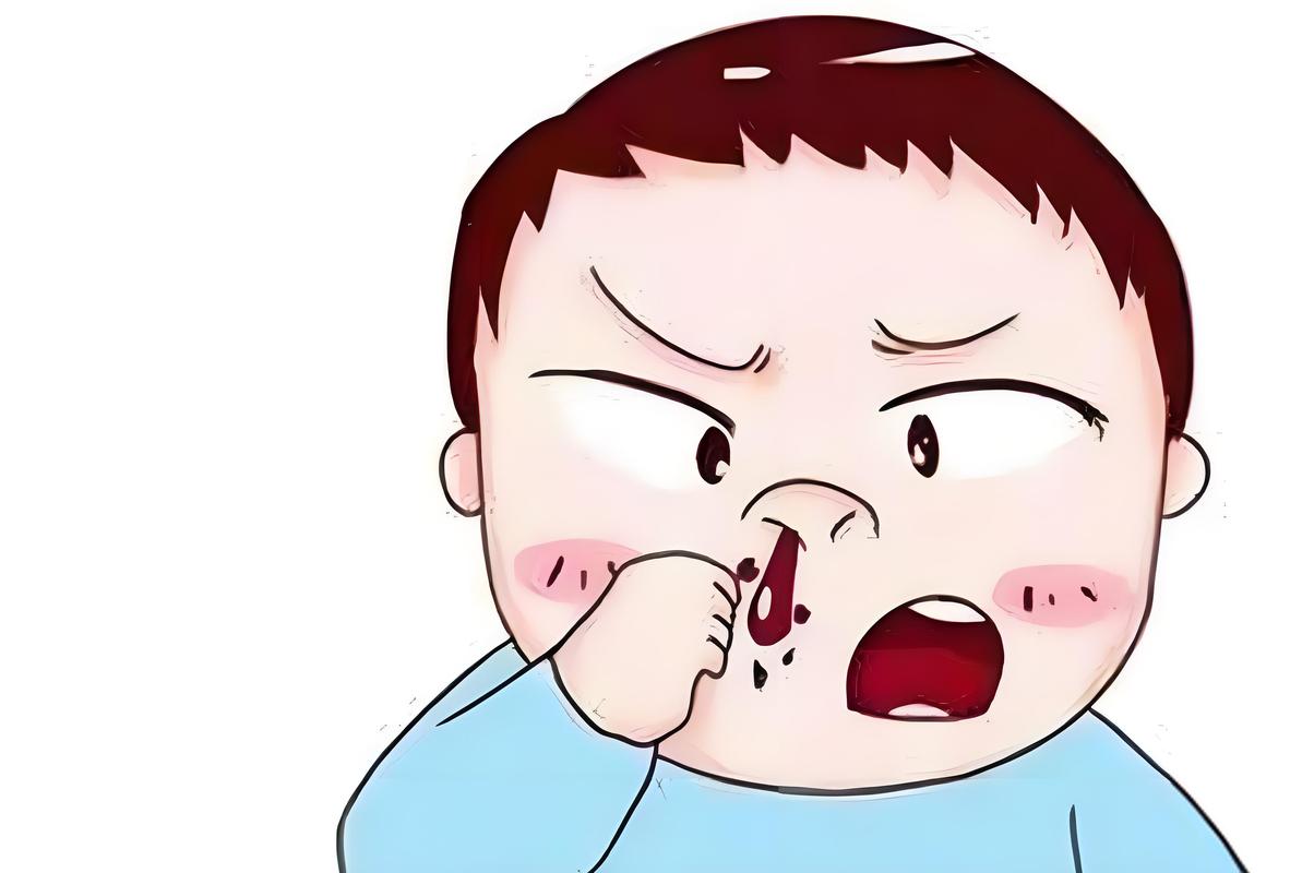 孩子老流鼻血