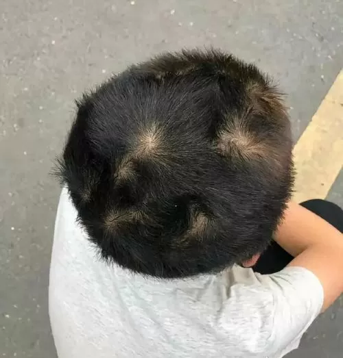 男孩有两个头旋