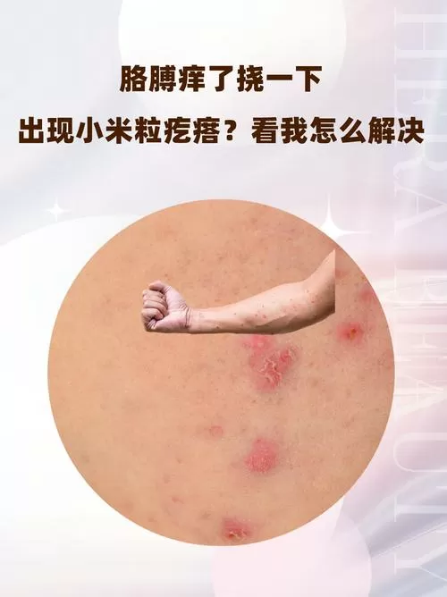 挠痒痒出现小疙瘩怎么回事
