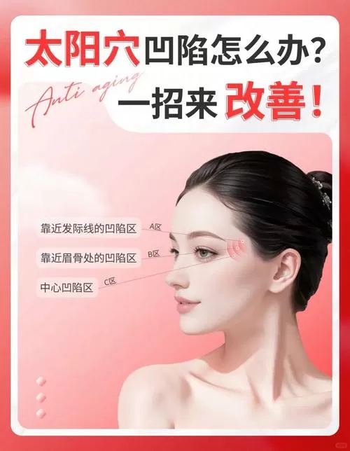 改善太阳凹陷自然方法