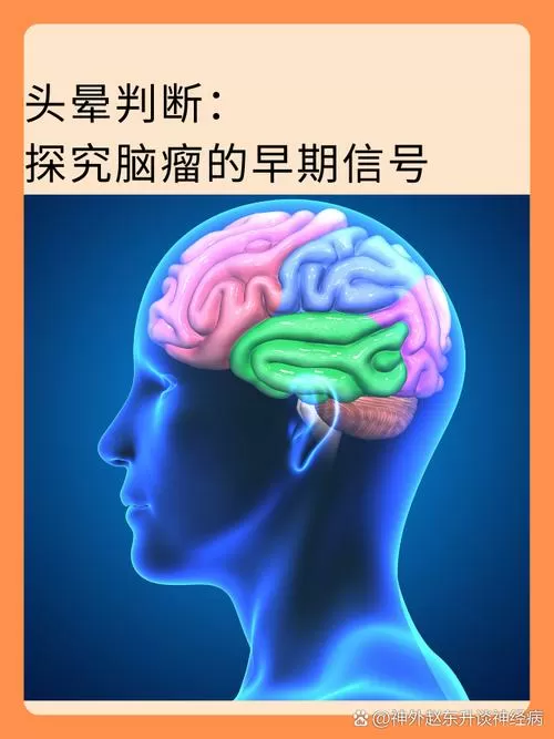 脑瘤头晕与普通头晕