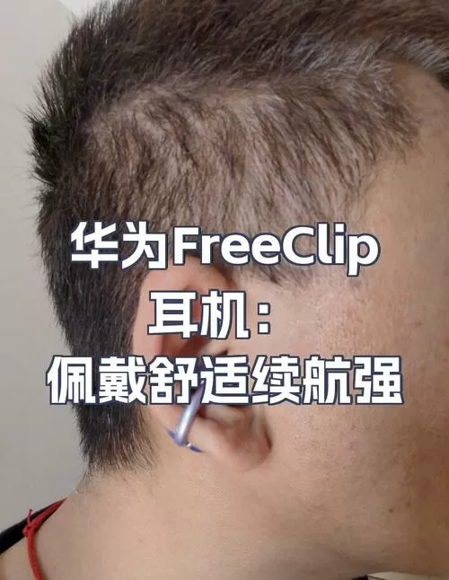 freeclip2正确戴法