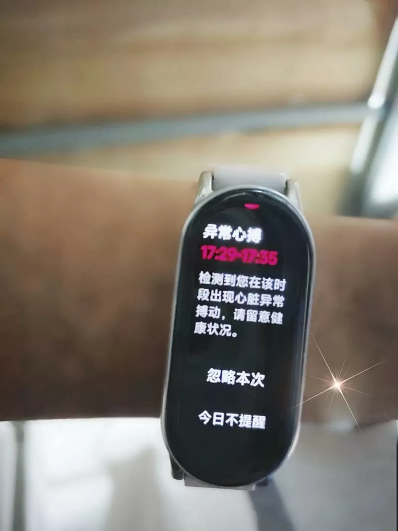 小米手表心率测量失败