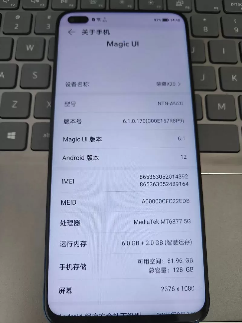 荣耀x20为什么被称为神机呢