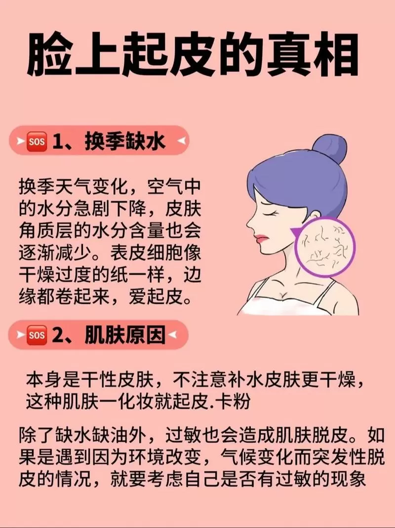 皮肤脱皮是什么原因