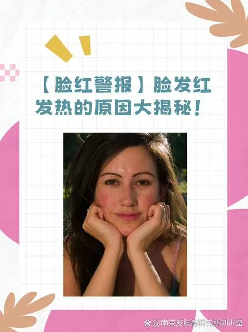 照片人脸偏红怎么处理