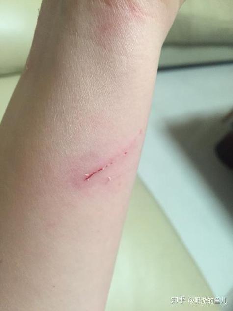 被宠物猫抓了一条红痕