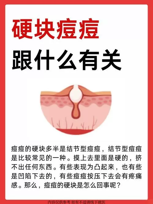 脸上长痘肿了有硬块怎么办