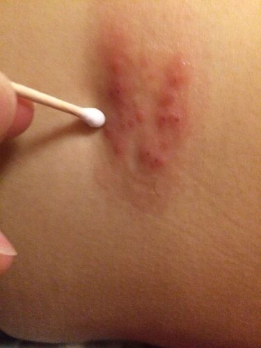 右侧肋骨下经常感觉痒痒的