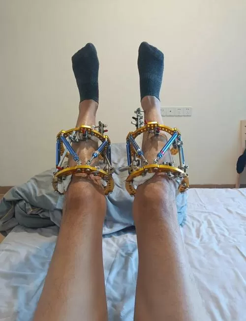 足枷固定脚趾口球蒙眼挠痒痒