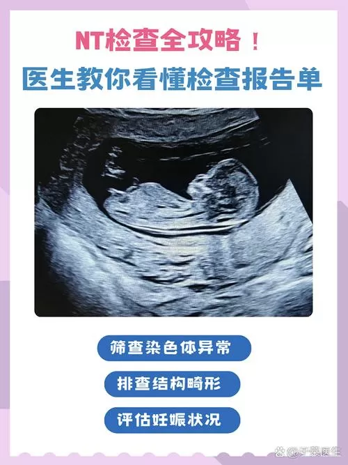 nt检查的通过率