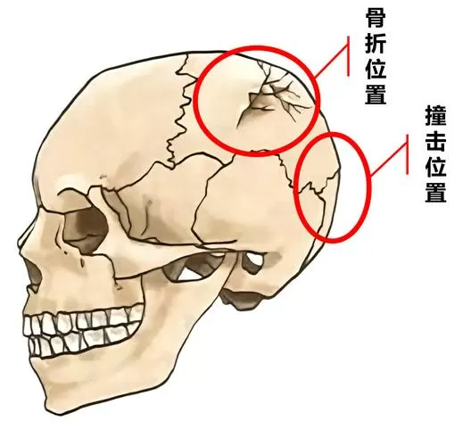 岩骨在头的哪个位置