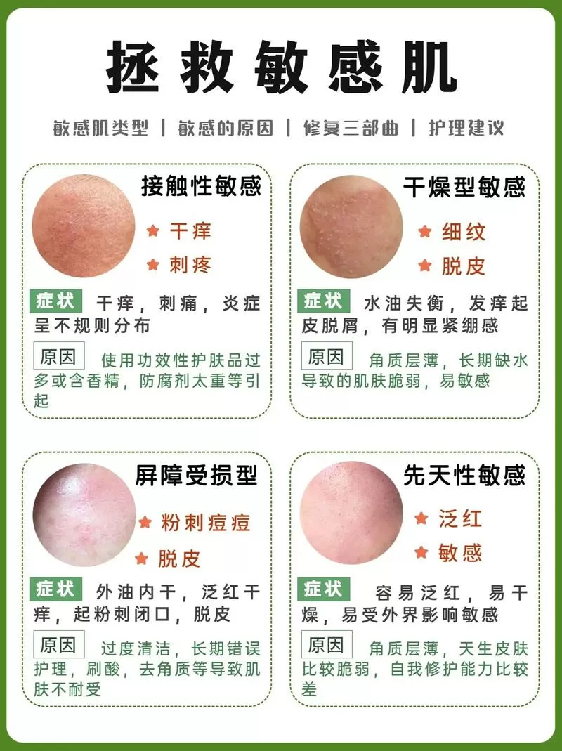 脸部过敏发红怎么修复