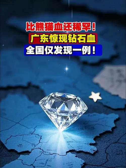 山东发现1例钻石血