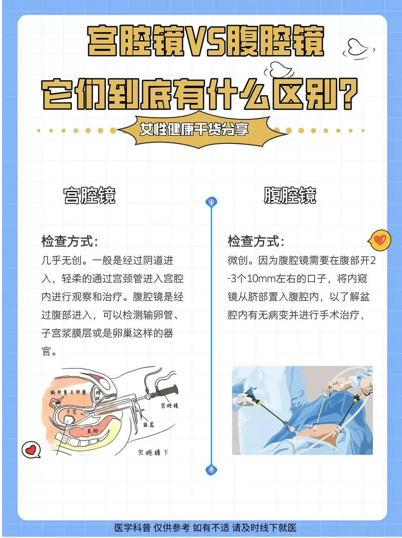 腹腔镜与宫腔镜有什么区别