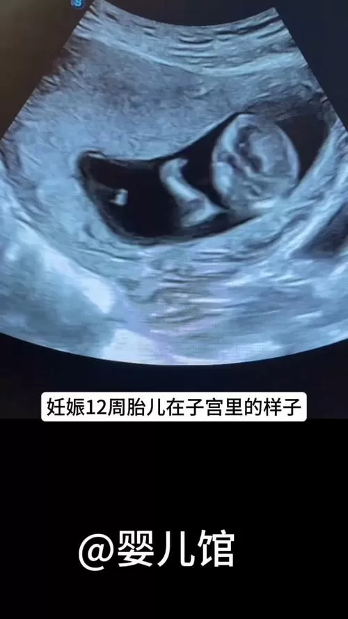 12周胎儿的生殖是怎么样的?