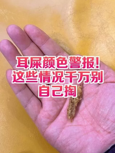 三十年不掏的干耳屎