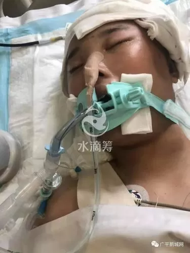车祸昏迷不醒能活多久