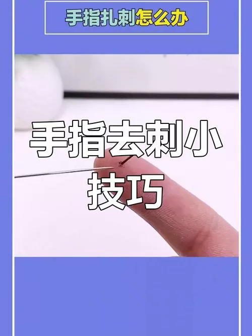 扎了刺怎么取出来