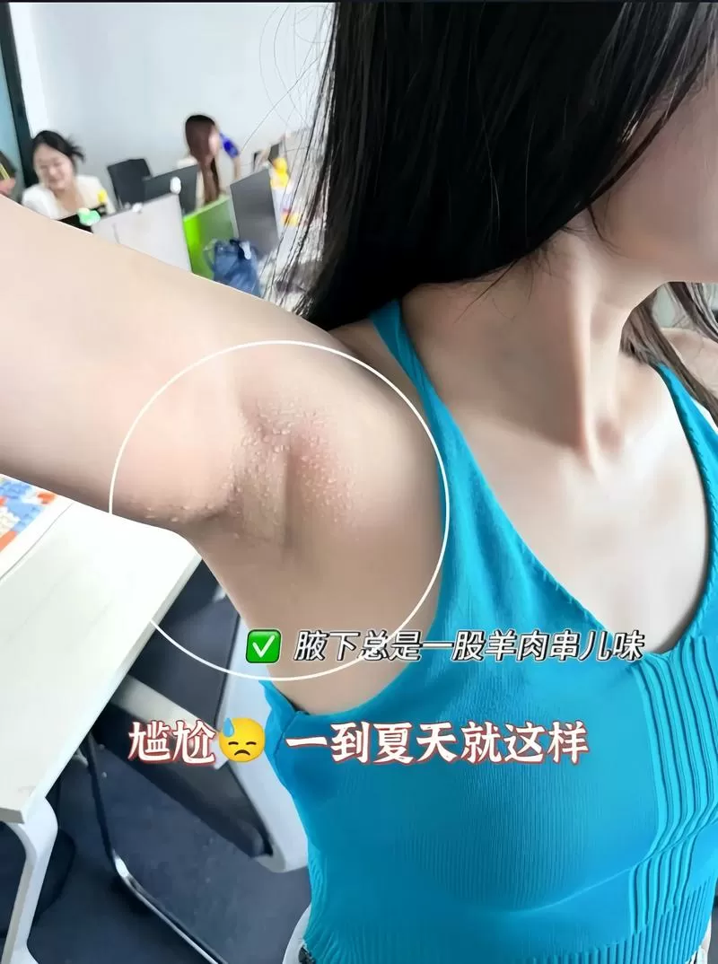 腋下味道大但不是狐臭