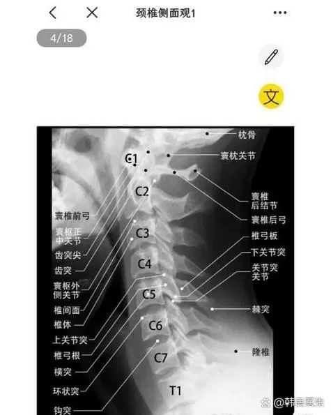 颈椎腰椎30分钟原版视频教程