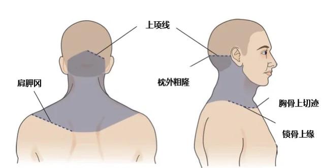 脖子上青块是如何造成的