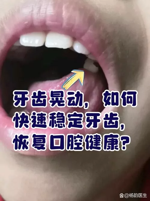 牙晃动的厉害什么方法能弄掉