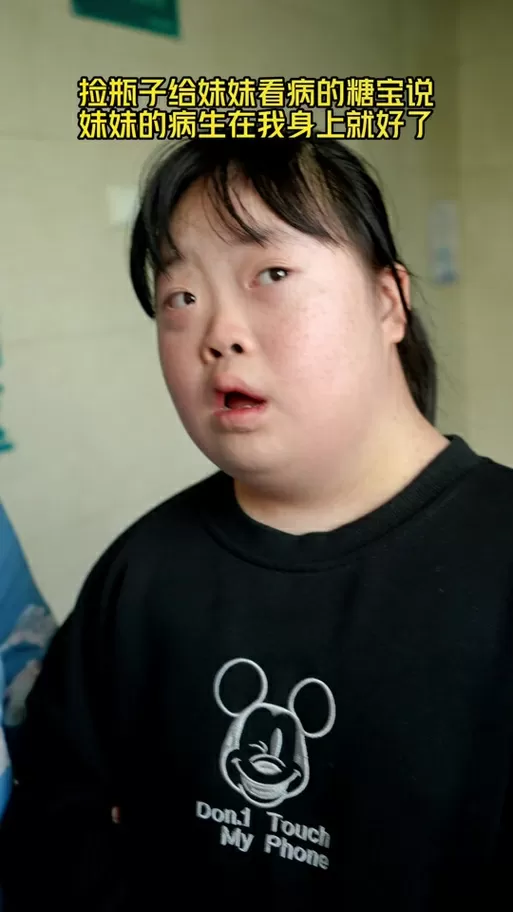 唐氏综合征为什么叫糖宝